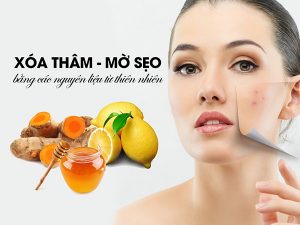 Cách xoá sẹo trên mặt bằng phương pháp tự nhiên