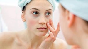 Những lưu ý khi sử dụng hoạt chất thay thế tretinoin và retinol