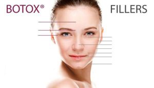 Tiêm filler và botox khác nhau như thế nào?