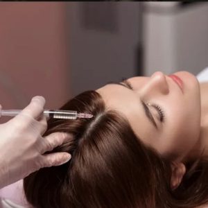 Tiêm mesotherapy mọc tóc