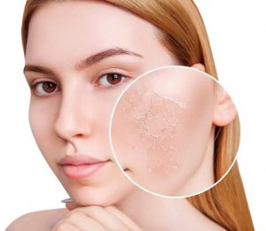 Top các sản phẩm skincare da khô