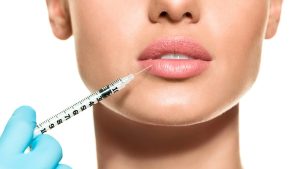 Ưu điểm của tiêm filler môi